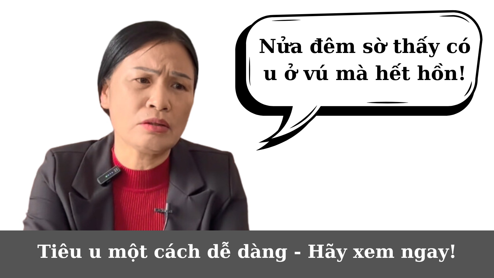 Đã có giải pháp mới trong điều trị u xơ tử cung, u nang buồng trứng, u vú lành tính